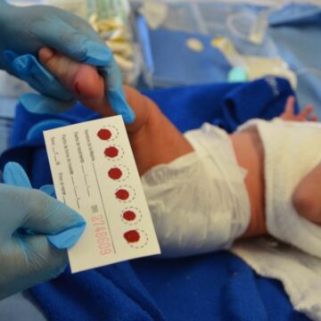 falsoquesehayasuspendidotamizneonatalenm-2304730 Secretaría de Salud asegura que tamiz neonatal no se ha suspendido