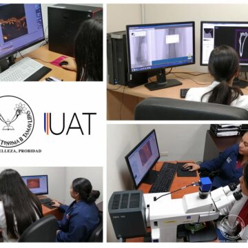 Foto_2_fibromialogia_01_12_19 Desarrolla UAT investigación para el tratamiento de fibromialgia