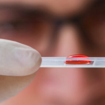 forense Suman 17,799 los casos positivos de Covid-19 en México