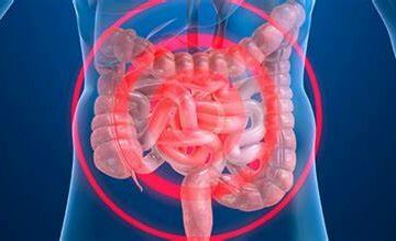 Enfermedad de Crohn: qué es lo padece el polémico youtuber MrBeast